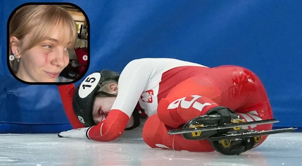 Kamila Sellier pokazała bliznę po fatalnym wypadku. Dodała trzy słowa