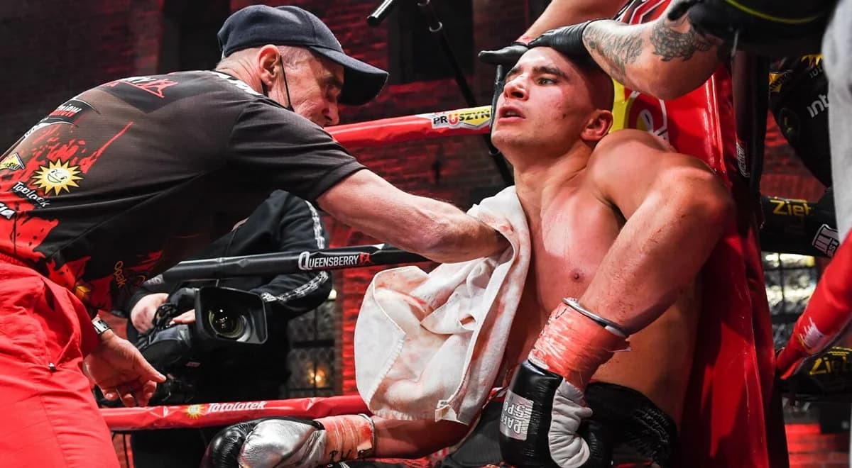 Nowe wieści po przerażającym nokaucie. Michał Soczyński jest w śpiączce